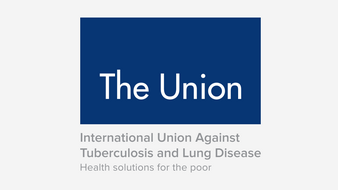The Union