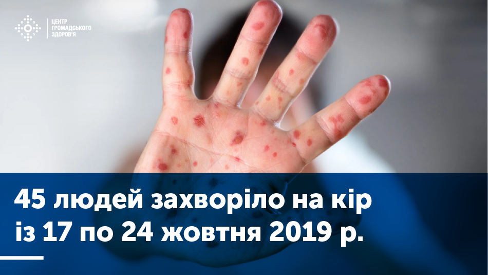 Дані захворюваності на кір (17 – 24 жовтня 2019)