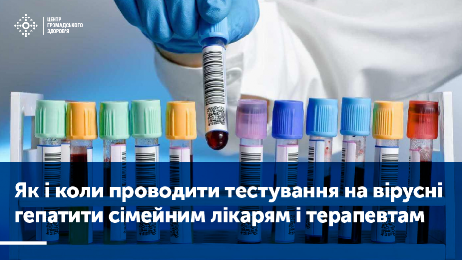 Як і коли проводити тестування на вірусні гепатити сімейним лікарям і терапевтам