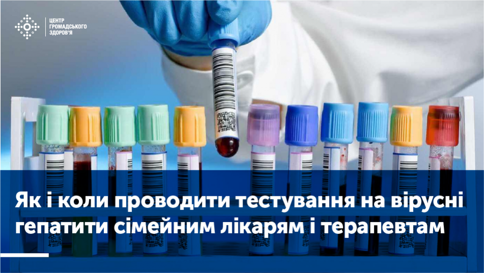  Як і коли проводити тестування на вірусні гепатити сімейним лікарям і терапевтам