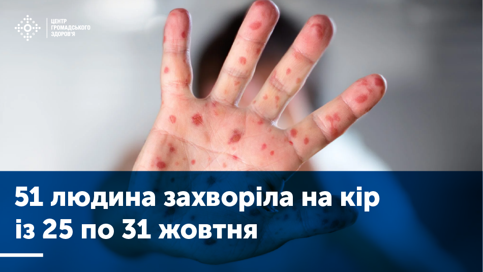 Дані захворюваності на кір (17–24 жовтня 2019)