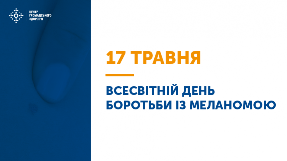 17 травня — Всесвітній день боротьби із меланомою.