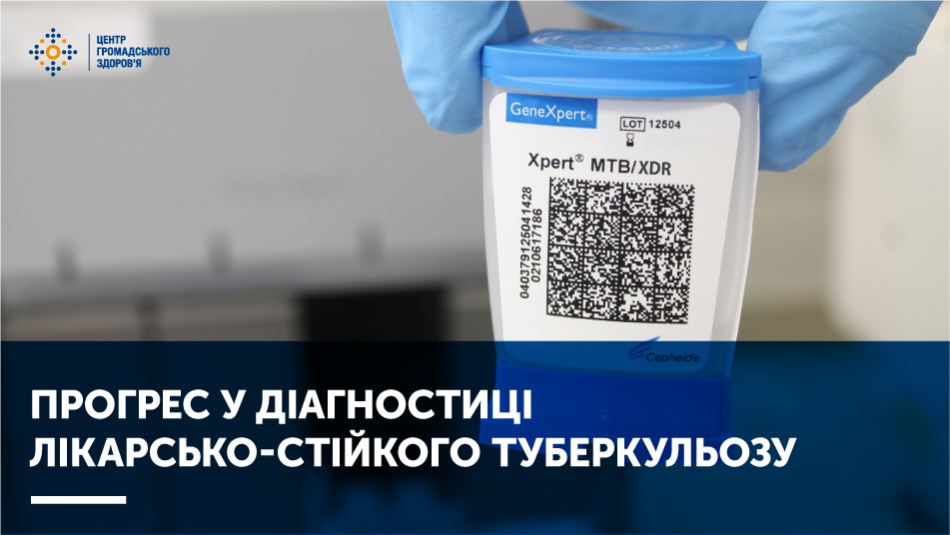 Прогрес у діагностиці лікарсько-стійкого туберкульозу