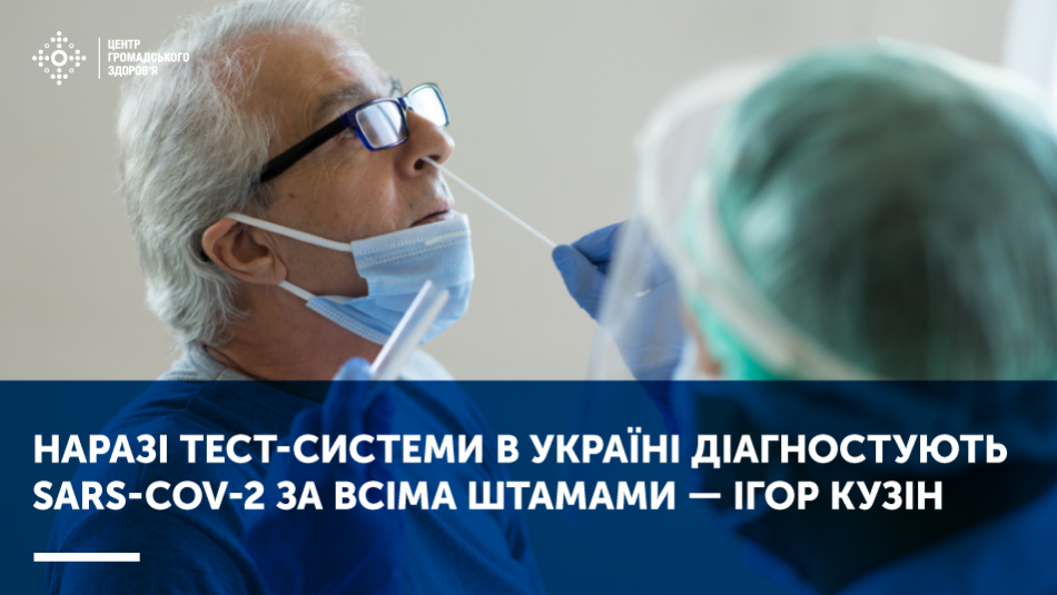 Наразі тест-системи в Україні діагностують SARS-CoV-2 за всіма штамами коронавірусу — Ігор Кузін