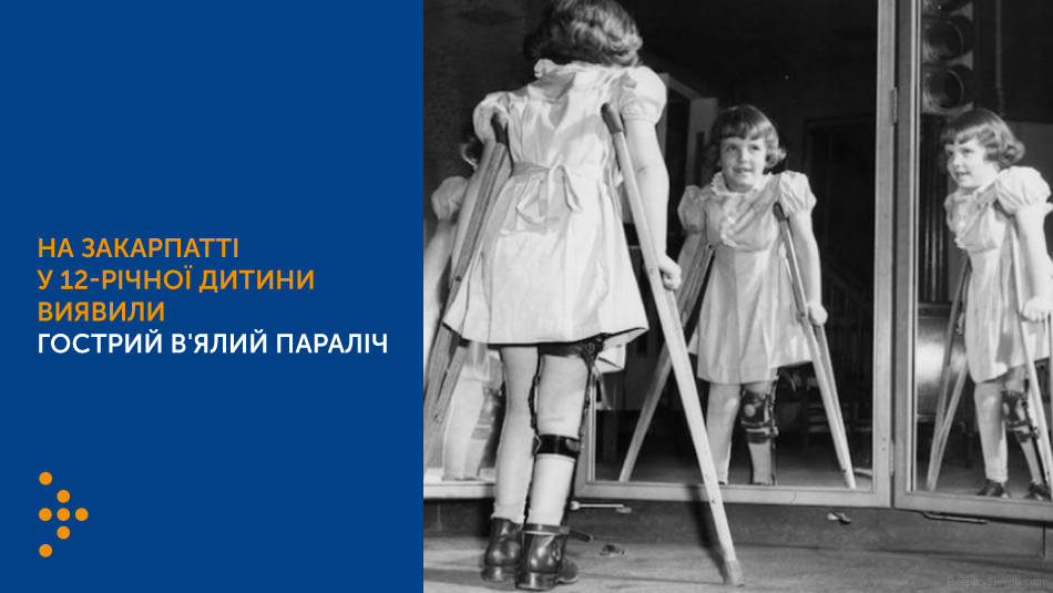 На Закарпатті у 12-річної дитини виявили гострий в'ялий параліч. Цей випадок не пов'язаний з зареєстрованим випадком гострого в'ялого паралічу у 17-місячної дитини з Рівненщини, спричиненого дериватом вакцинного поліовірусу типу 2 (VDPV2)