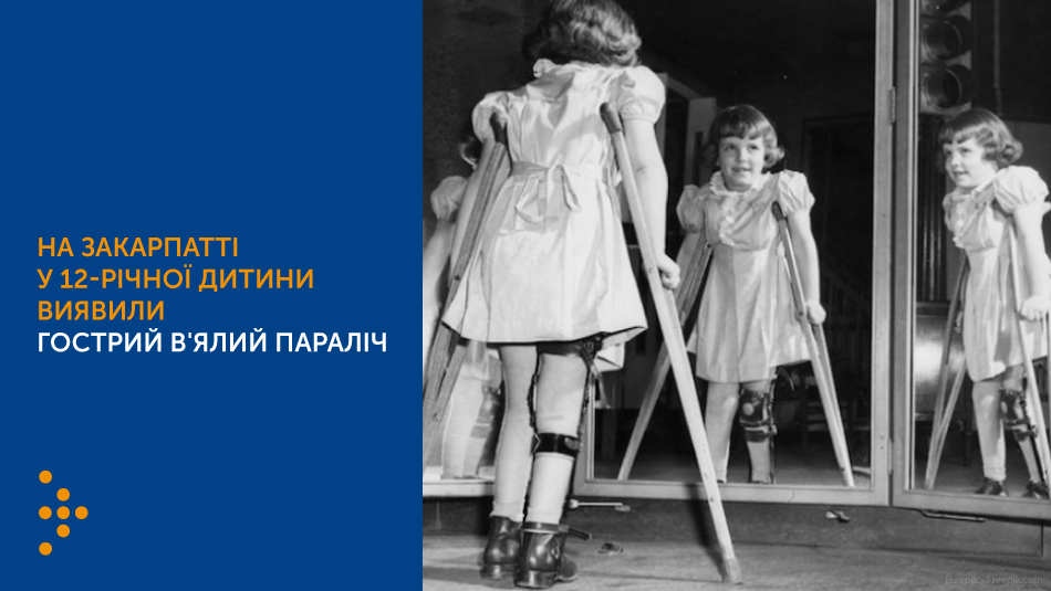 На Закарпатті у 12-річної дитини виявили гострий в'ялий параліч. Цей випадок не пов'язаний з зареєстрованим випадком гострого в'ялого паралічу у 17-місячної дитини з Рівненщини, спричиненого дериватом вакцинного поліовірусу типу 2 (VDPV2)