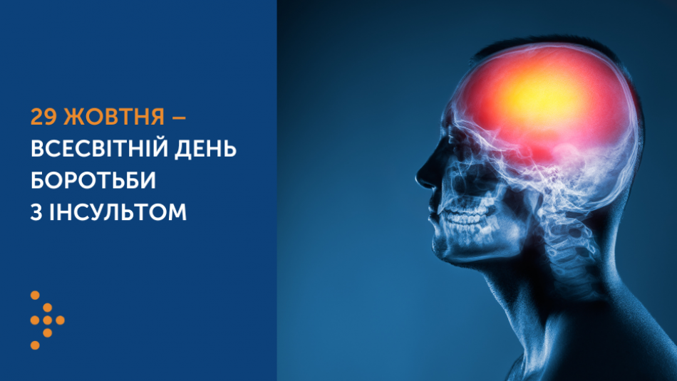 29 жовтня – Всесвітній день боротьби з інсультом: як розпізнати симптоми та чому важливо зробити це вчасно