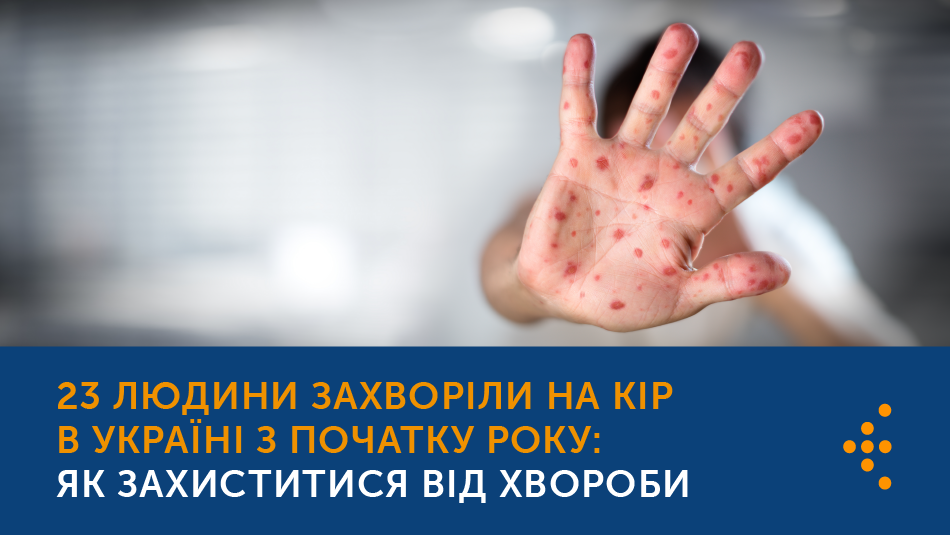 23 людини захворіли на кір в Україні з початку року: як захиститися від хвороби