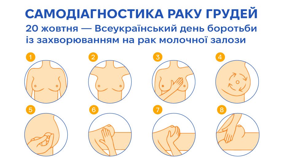 Рак молочної залози: як розпізнати та запобігти