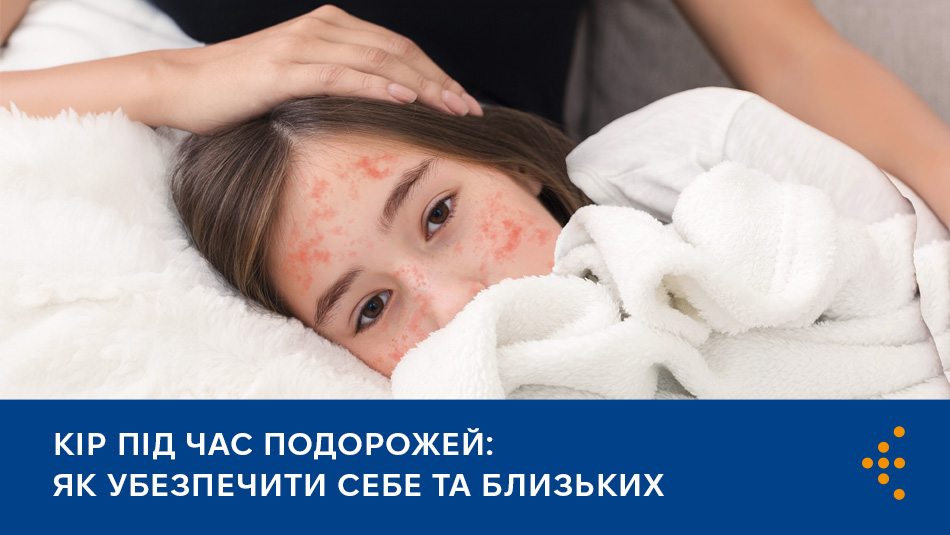 Кір може стати серйозною загрозою для здоров’я, а іноді навіть життя, особливо під час подорожей.