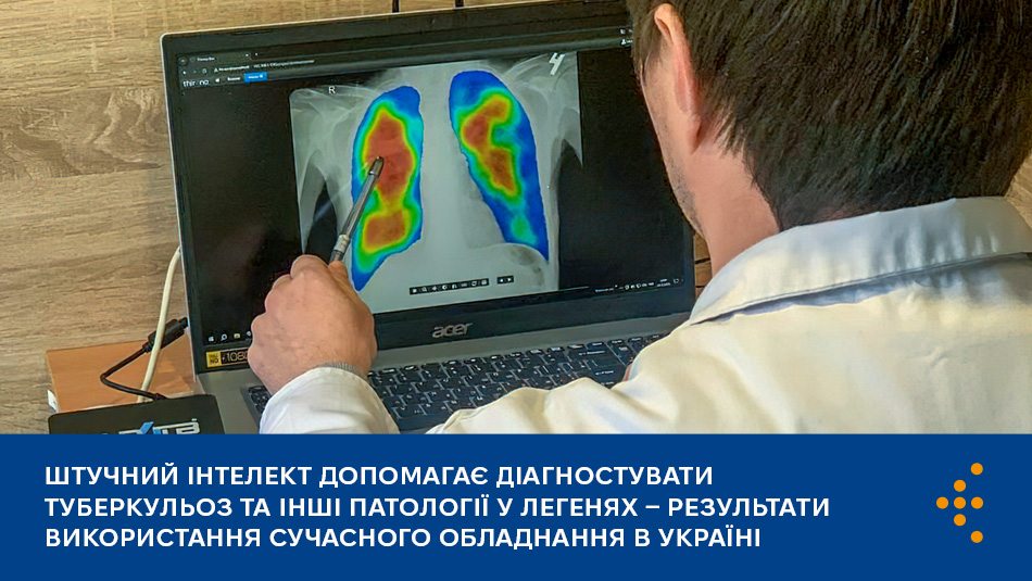 Штучний інтелект допомагає діагностувати туберкульоз та інші патології у легенях — результати використання сучасного обладнання в Україні