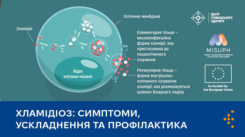 Хламідіоз: симптоми, ускладнення та профілактика 