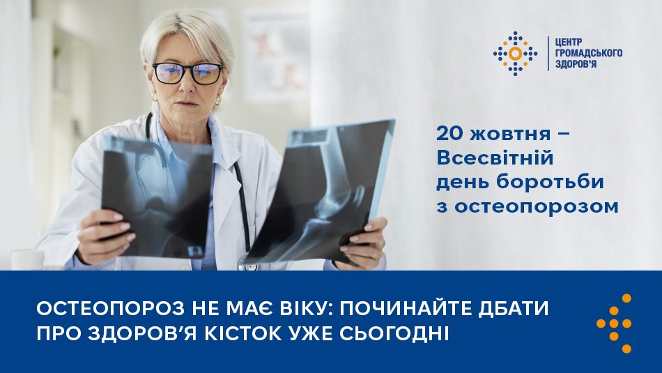 Остеопороз не має віку: починайте дбати про здоров’я кісток уже сьогодні 